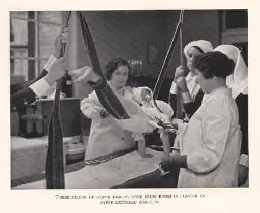 Picture of Stannington, Tuberculosis Treatment
